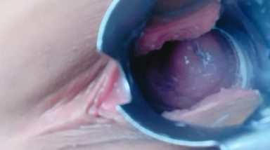 气质妹子，扩阴器撑开阴道可以看到子宫颈，粉嫩如初，再用道具往里面插