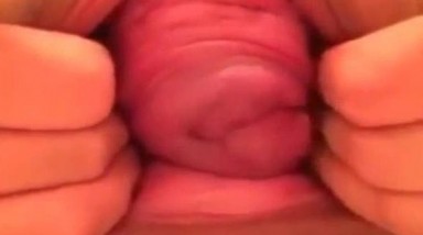 大开眼界啊 能把自己浪屄和菊花玩成这样也绝啦 前面是子宫脱垂后面是脱肛 是不是废了