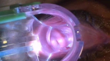 骚母狗变态扩张 看子宫灌肠注射灌膀胱疯狂虐阴1080P高清原版