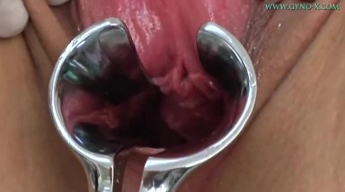 小伙子带漂亮女友来妇科检查，项目太全面了，不过子宫很干净，生出的娃一定很健康